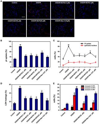 Neuroprotective Effect of β-Caryophyllene on Cerebral Ischemia-Reperfusion Injury via Regulation of Necroptotic Neuronal Death and Inflammation: In Vivo and in Vitro